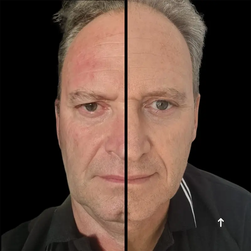 WonderFace facial contouring results — Overall