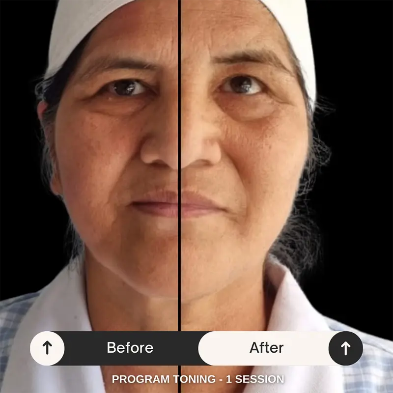 WonderFace facial contouring results — Face Toning